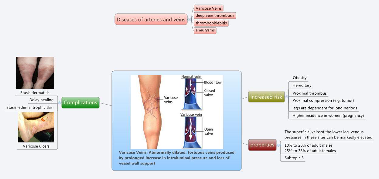 varicose-veins-abnormally-dilated-tortuous-veins-produced-by